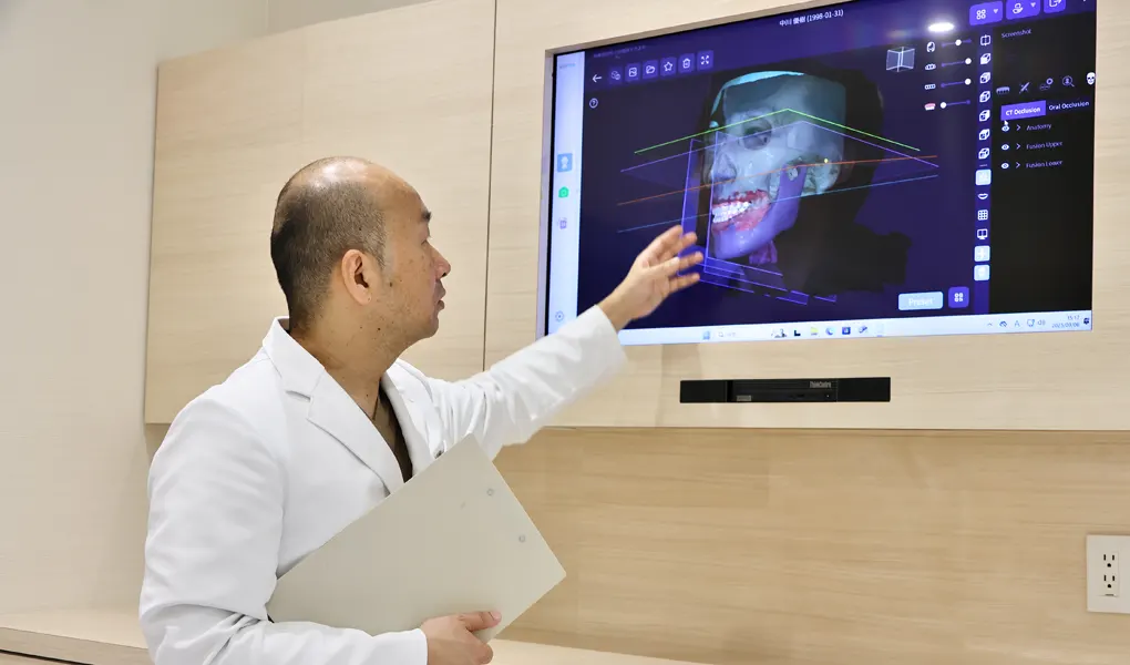 3Dフェイススキャナー